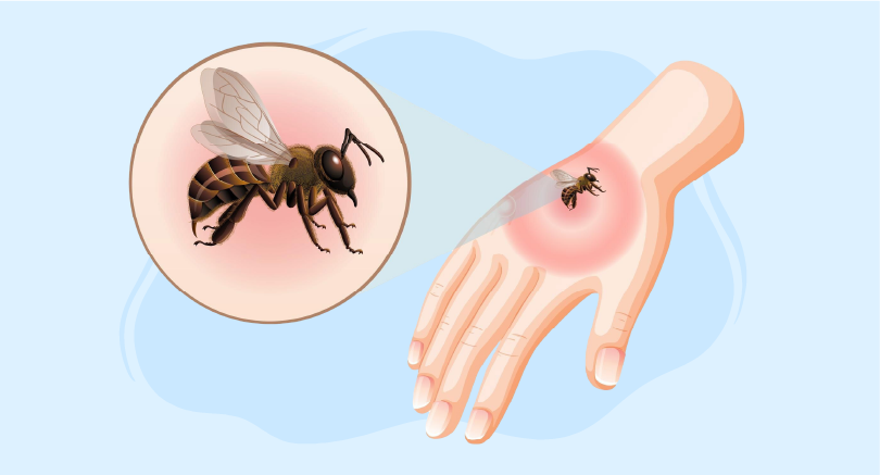 chikungunya virus course